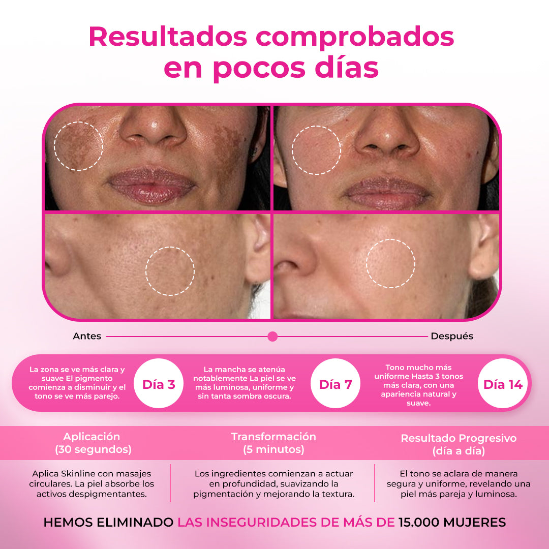 SkinLine® | Crema aclarante corporal